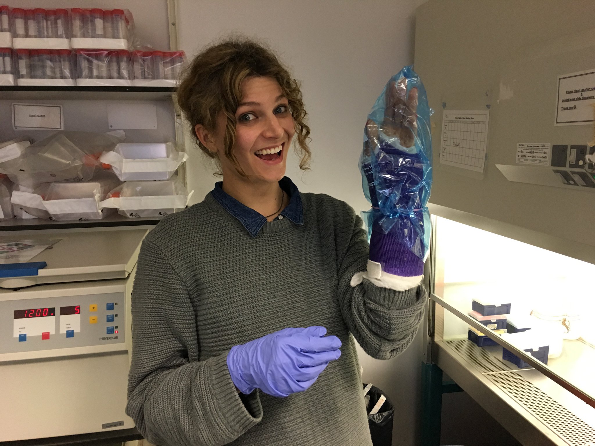 #Cancer immunology researcher Louise's vital lab work doesn't stop.... even with a broken wrist!!! #AdaLovelaceDay #ALD17 https://t.co/TGyiUNbokC